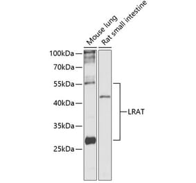 Western Blot - Anti-LRAT Antibody (A87661) - Antibodies.com