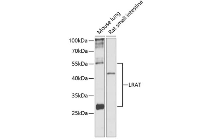 Western Blot - Anti-LRAT Antibody (A87661) - Antibodies.com