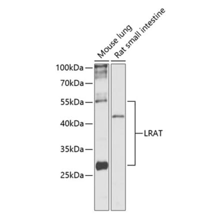Western Blot - Anti-LRAT Antibody (A87661) - Antibodies.com