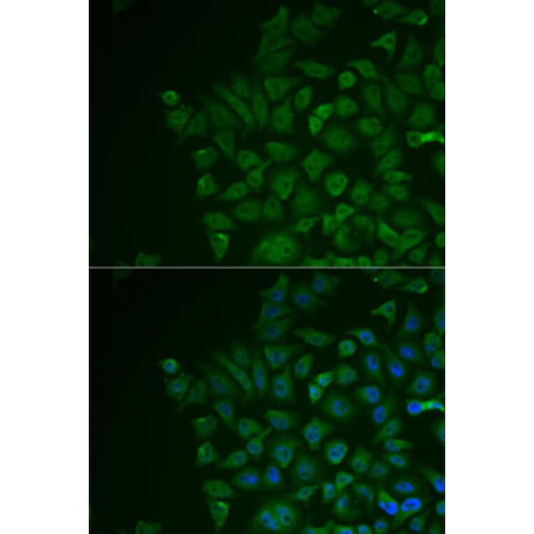 Immunofluorescence - Anti-LRAT Antibody (A87661) - Antibodies.com