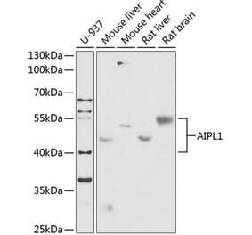 Western Blot - Anti-AIPL1 Antibody (A87662) - Antibodies.com