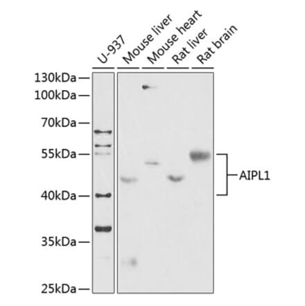 Western Blot - Anti-AIPL1 Antibody (A87662) - Antibodies.com