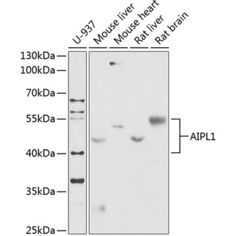 Western Blot - Anti-AIPL1 Antibody (A87662) - Antibodies.com