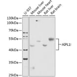 Western Blot - Anti-AIPL1 Antibody (A87662) - Antibodies.com