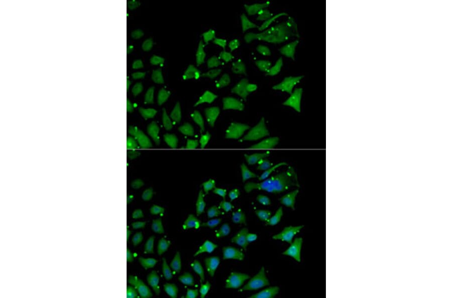 Immunofluorescence - Anti-AIPL1 Antibody (A87662) - Antibodies.com
