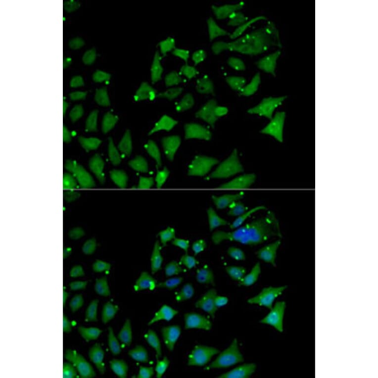 Immunofluorescence - Anti-AIPL1 Antibody (A87662) - Antibodies.com