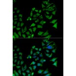 Immunofluorescence - Anti-AIPL1 Antibody (A87662) - Antibodies.com