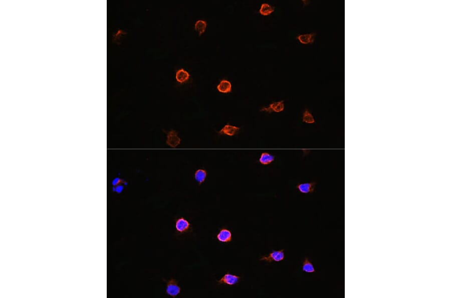 Immunofluorescence - Anti-AIPL1 Antibody (A87662) - Antibodies.com