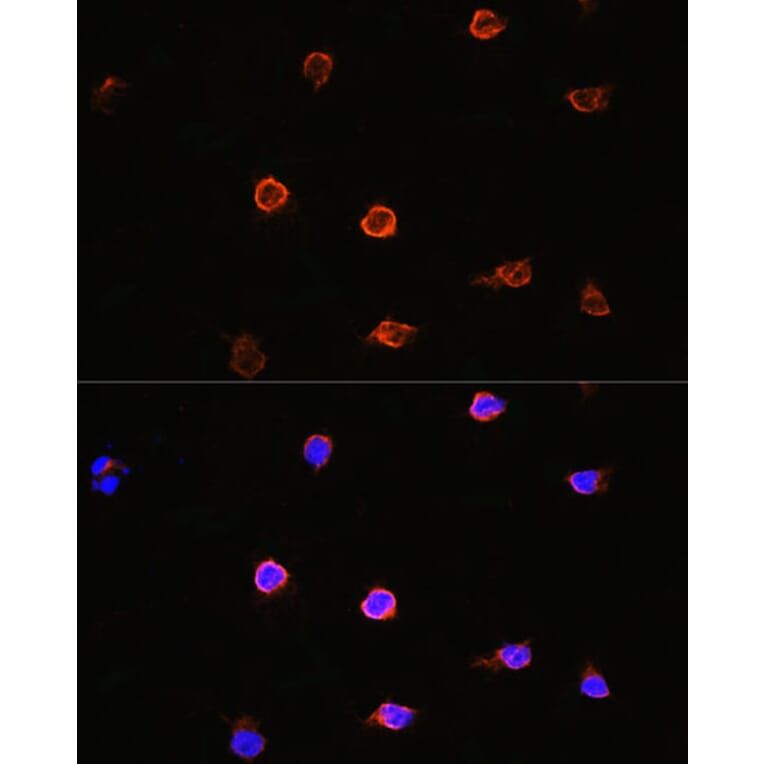 Immunofluorescence - Anti-AIPL1 Antibody (A87662) - Antibodies.com