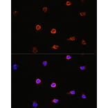 Immunofluorescence - Anti-AIPL1 Antibody (A87662) - Antibodies.com