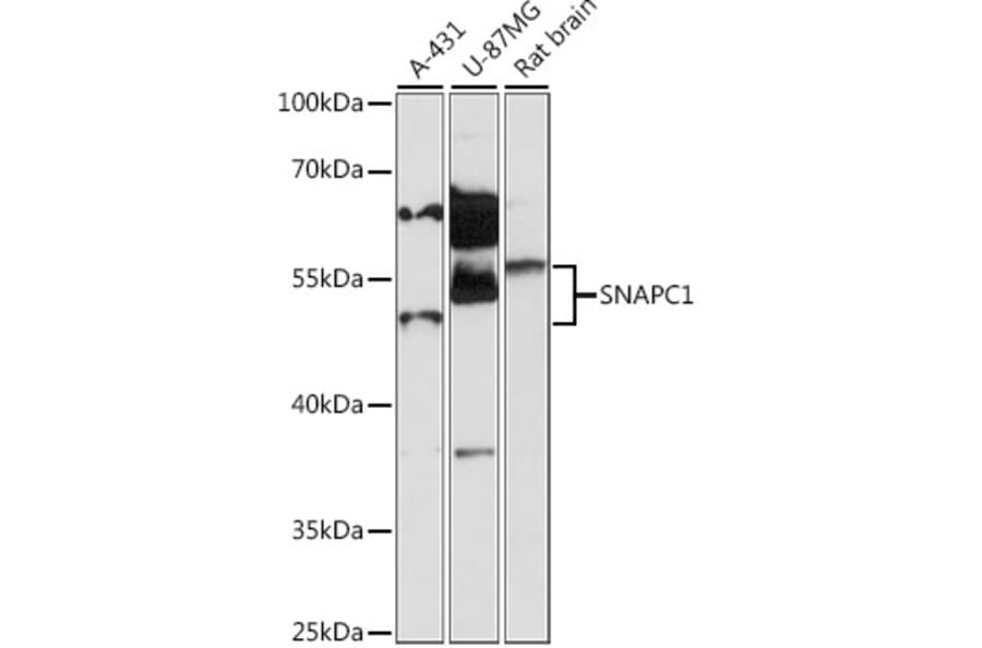 Western Blot - Anti-SNAPC1 Antibody (A87663) - Antibodies.com