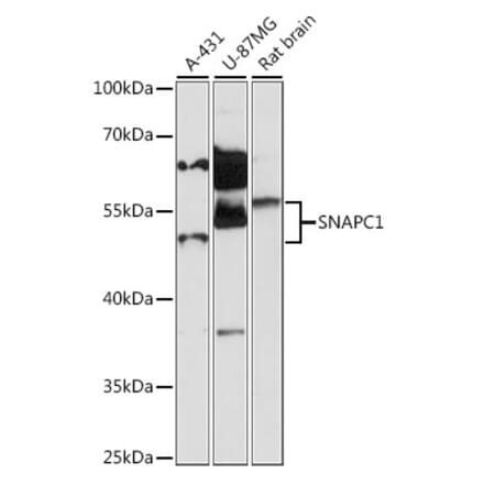 Western Blot - Anti-SNAPC1 Antibody (A87663) - Antibodies.com