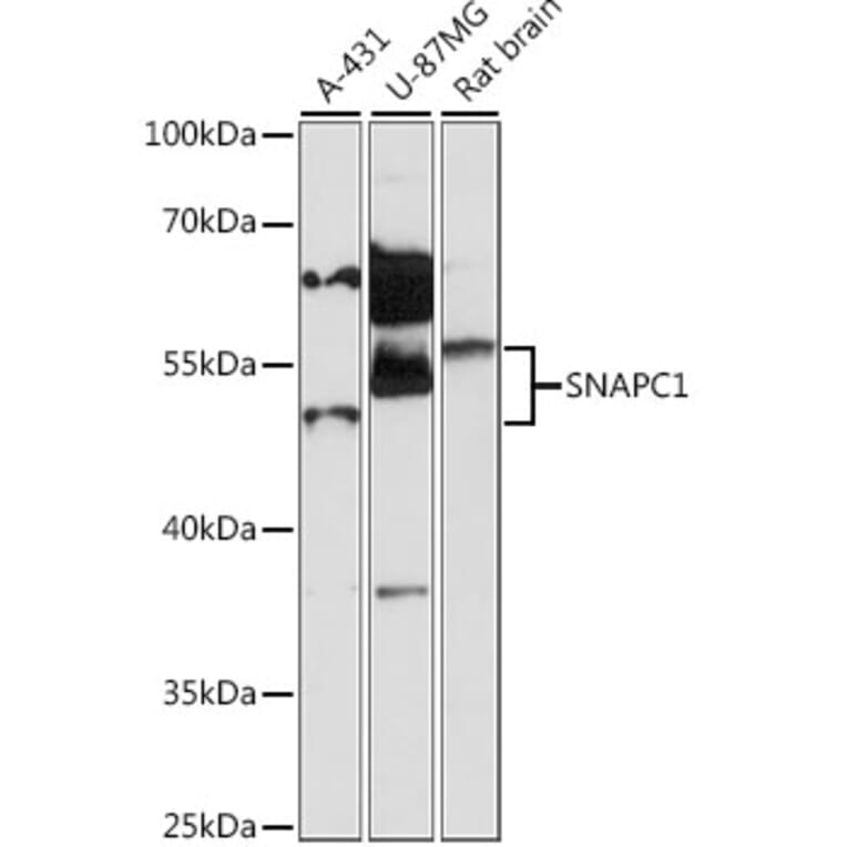 Western Blot - Anti-SNAPC1 Antibody (A87663) - Antibodies.com