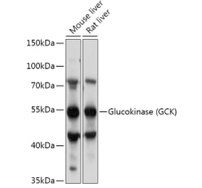 Western Blot - Anti-Glucokinase Antibody (A87664) - Antibodies.com