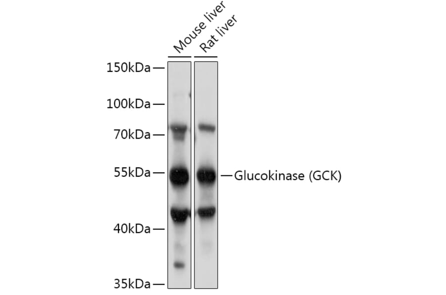 Western Blot - Anti-Glucokinase Antibody (A87664) - Antibodies.com