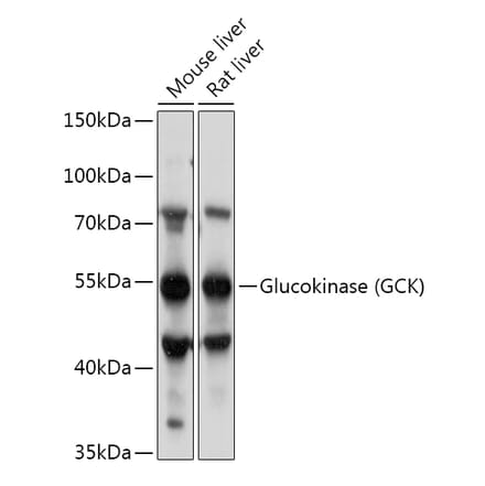 Western Blot - Anti-Glucokinase Antibody (A87664) - Antibodies.com