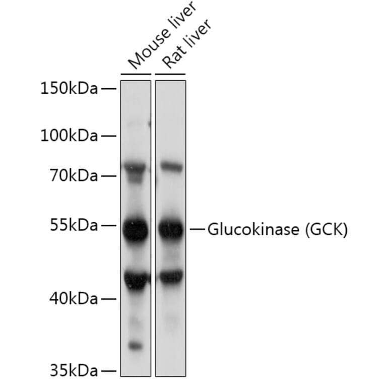 Western Blot - Anti-Glucokinase Antibody (A87664) - Antibodies.com