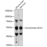 Western Blot - Anti-Glucokinase Antibody (A87664) - Antibodies.com