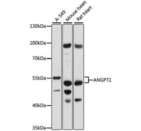 Western Blot - Anti-Angiopoietin 1 Antibody (A87665) - Antibodies.com