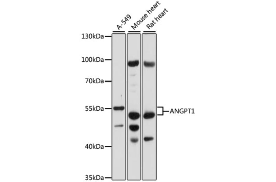 Western Blot - Anti-Angiopoietin 1 Antibody (A87665) - Antibodies.com