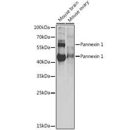 Western Blot - Anti-Pannexin 1 Antibody (A87666) - Antibodies.com