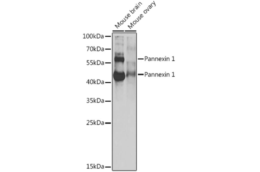 Western Blot - Anti-Pannexin 1 Antibody (A87666) - Antibodies.com
