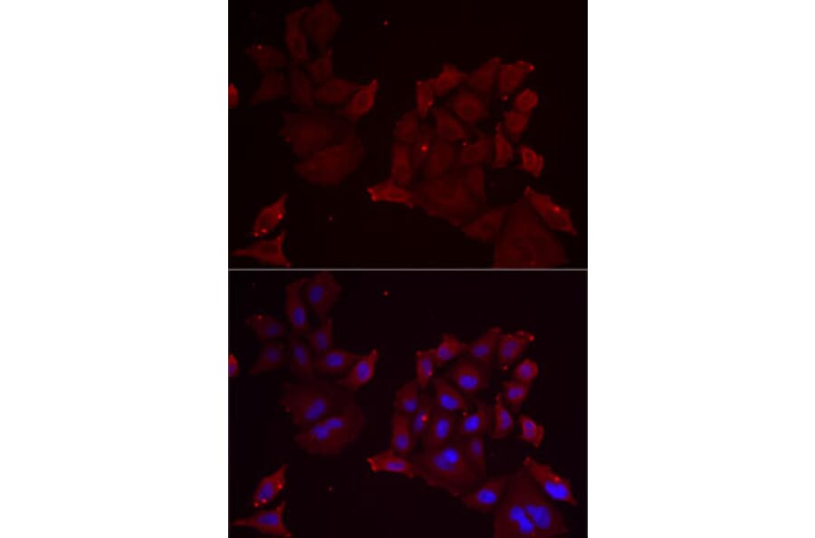 Immunofluorescence - Anti-Pannexin 1 Antibody (A87666) - Antibodies.com