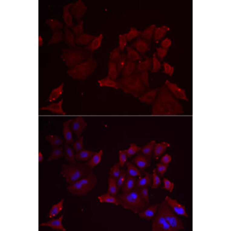 Immunofluorescence - Anti-Pannexin 1 Antibody (A87666) - Antibodies.com