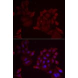 Immunofluorescence - Anti-Pannexin 1 Antibody (A87666) - Antibodies.com