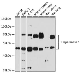 Western Blot - Anti-Heparanase 1 Antibody (A87667) - Antibodies.com