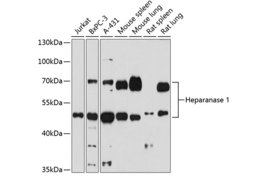 Western Blot - Anti-Heparanase 1 Antibody (A87667) - Antibodies.com