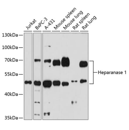 Western Blot - Anti-Heparanase 1 Antibody (A87667) - Antibodies.com