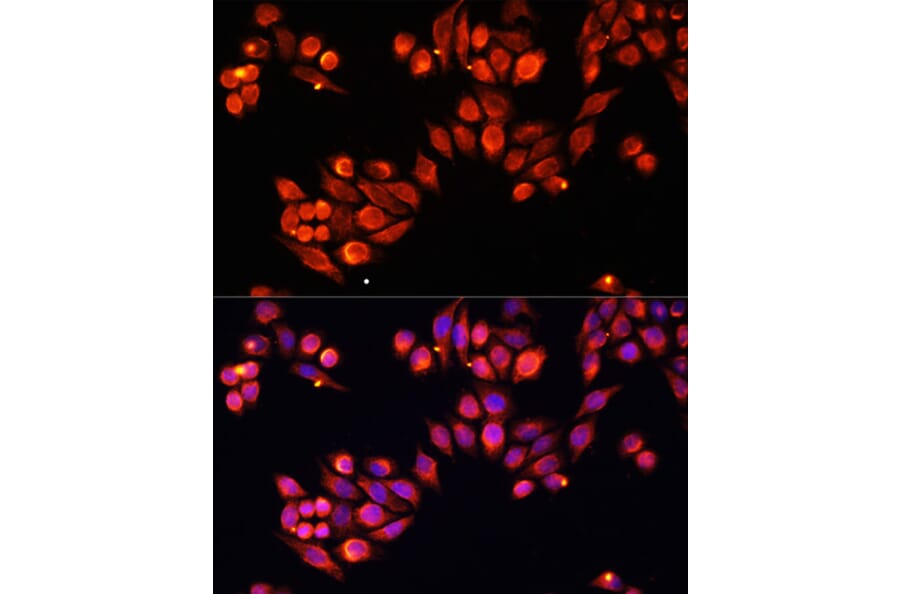 Immunofluorescence - Anti-Heparanase 1 Antibody (A87667) - Antibodies.com
