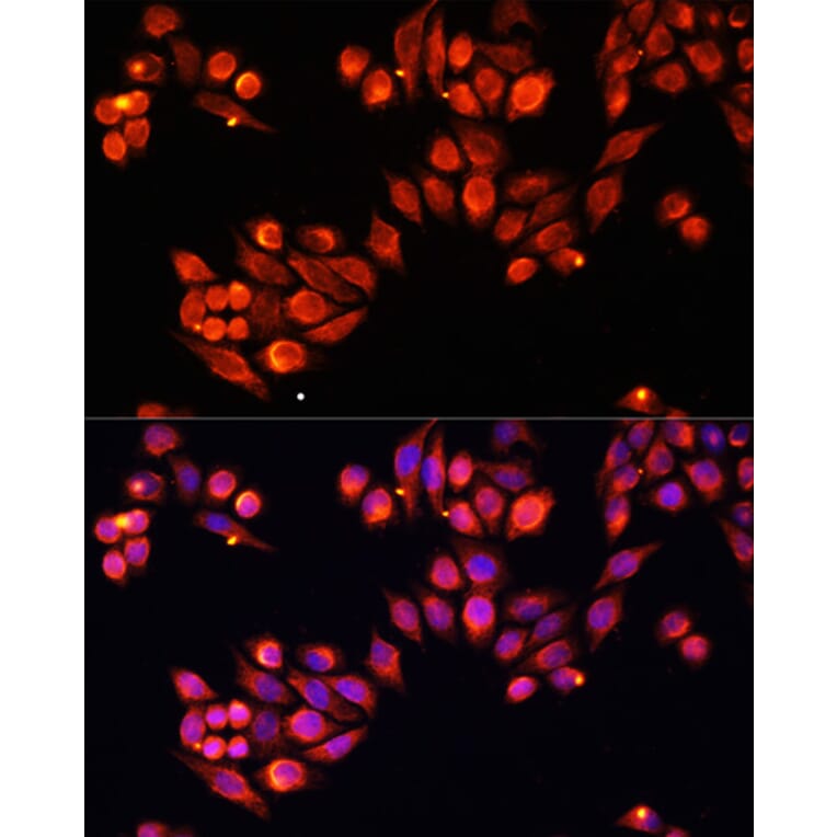 Immunofluorescence - Anti-Heparanase 1 Antibody (A87667) - Antibodies.com
