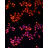 Immunofluorescence - Anti-Heparanase 1 Antibody (A87667) - Antibodies.com