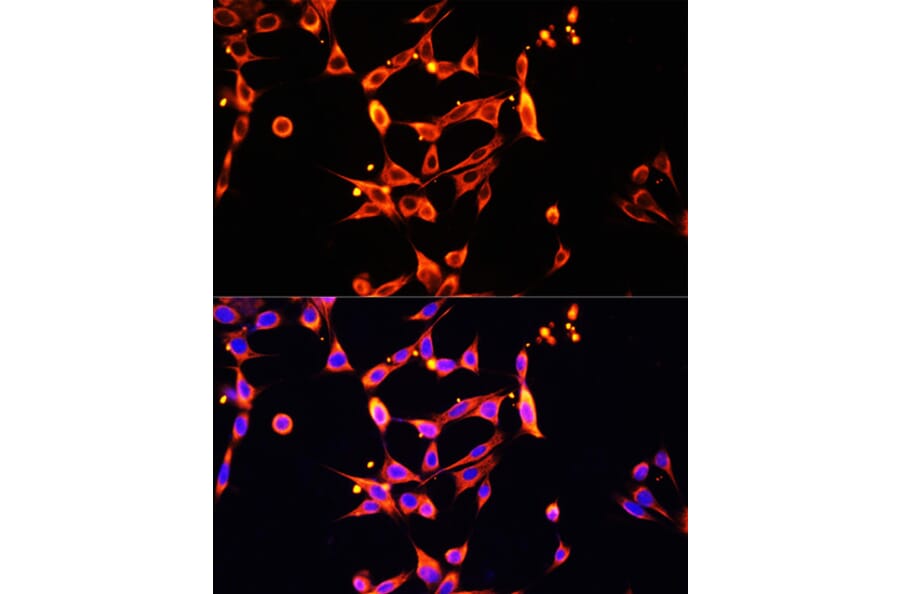 Immunofluorescence - Anti-Heparanase 1 Antibody (A87667) - Antibodies.com