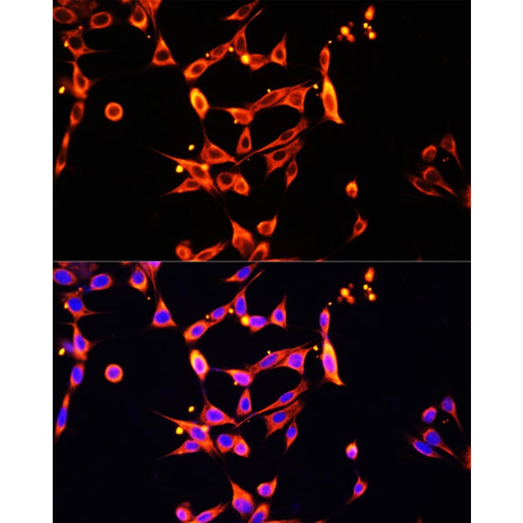 Immunofluorescence - Anti-Heparanase 1 Antibody (A87667) - Antibodies.com