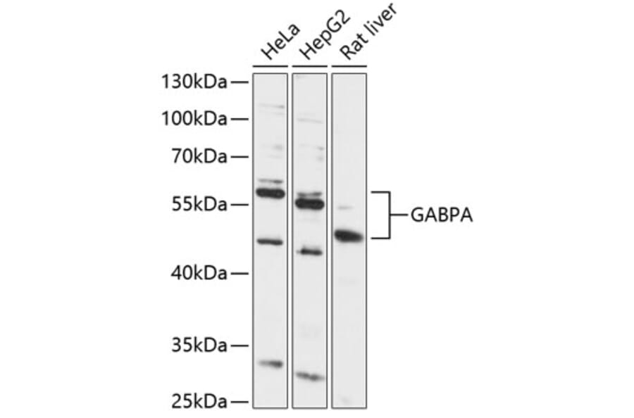 Western Blot - Anti-GABPA Antibody (A87668) - Antibodies.com