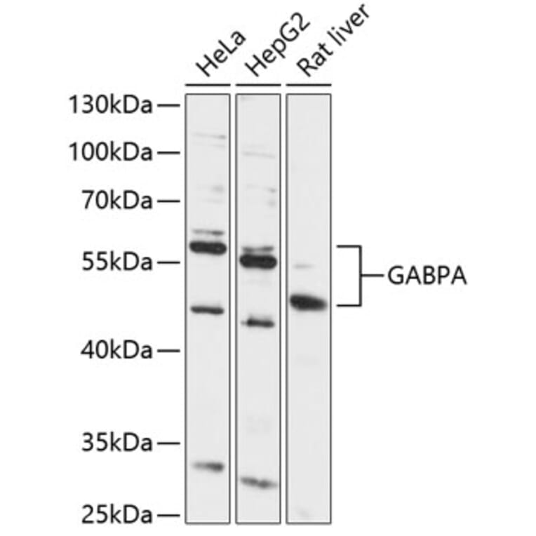 Western Blot - Anti-GABPA Antibody (A87668) - Antibodies.com