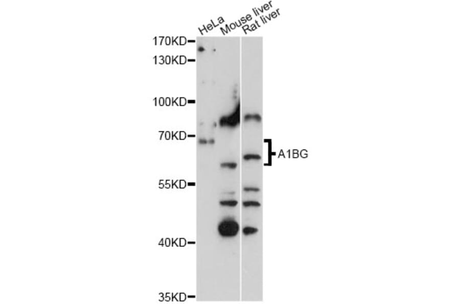 Western Blot - Anti-A1BG Antibody (A15015) - Antibodies.com