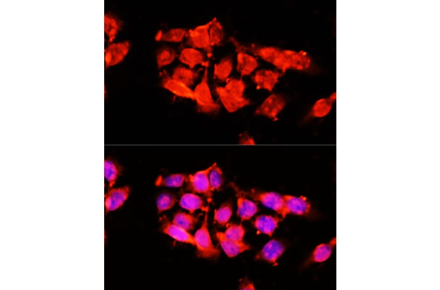 Immunofluorescence - Anti-A1BG Antibody (A15015) - Antibodies.com