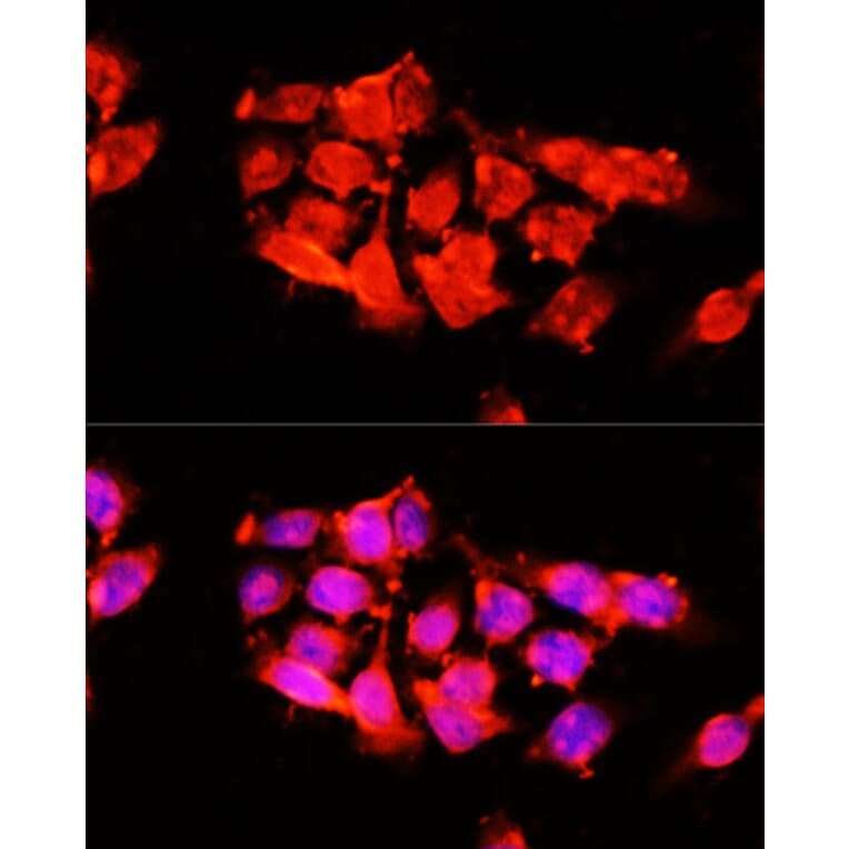 Immunofluorescence - Anti-A1BG Antibody (A15015) - Antibodies.com