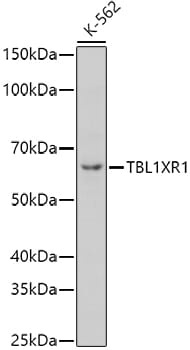 Western blot analysis of extracts of various cell lines, using Anti-TBL1XR1 Antibody (A13438) at 1:1,000 dilution.
Secondary antibody: Goat Anti-Rabbit IgG (H+L) (HRP) (AS014) at 1:10,000 dilution.
Lysates / proteins: 25µg per lane.
Blocking buffer: 3% non-fat dry milk in TBST.
Detection: ECL Basic Kit (RM00020).
Exposure time: 10s.