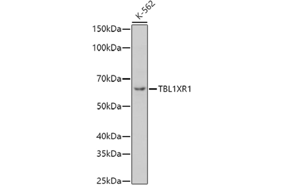 Western Blot - Anti-TBLR1/TBL1XR1 Antibody (A87670) - Antibodies.com