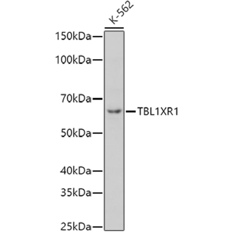 Western Blot - Anti-TBLR1/TBL1XR1 Antibody (A87670) - Antibodies.com
