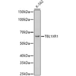 Western Blot - Anti-TBLR1/TBL1XR1 Antibody (A87670) - Antibodies.com