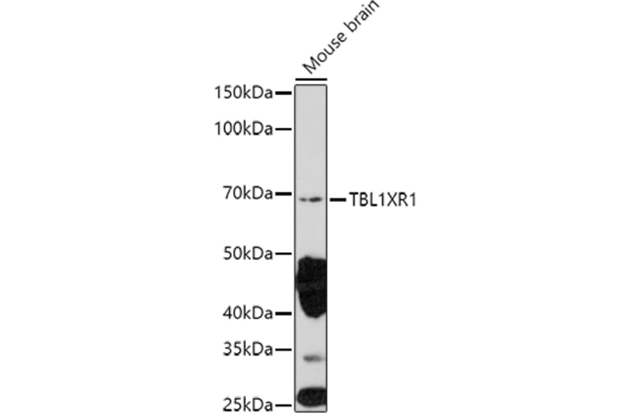 Western Blot - Anti-TBLR1/TBL1XR1 Antibody (A87670) - Antibodies.com