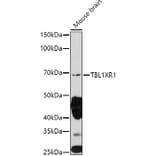 Western Blot - Anti-TBLR1/TBL1XR1 Antibody (A87670) - Antibodies.com