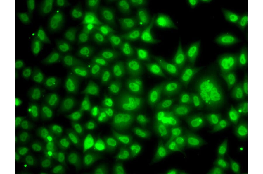 Immunofluorescence - Anti-TBLR1/TBL1XR1 Antibody (A87670) - Antibodies.com