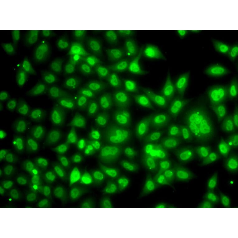 Immunofluorescence - Anti-TBLR1/TBL1XR1 Antibody (A87670) - Antibodies.com
